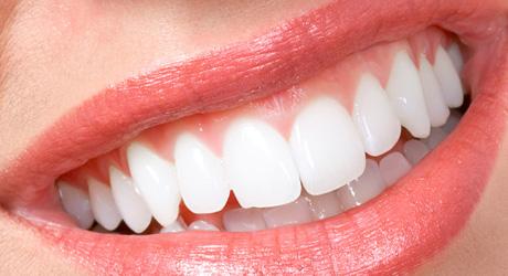 healthy teeth